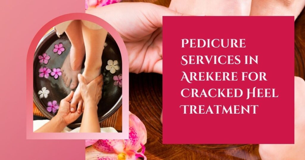 Pedicure services in arekere for cracked heel treatment